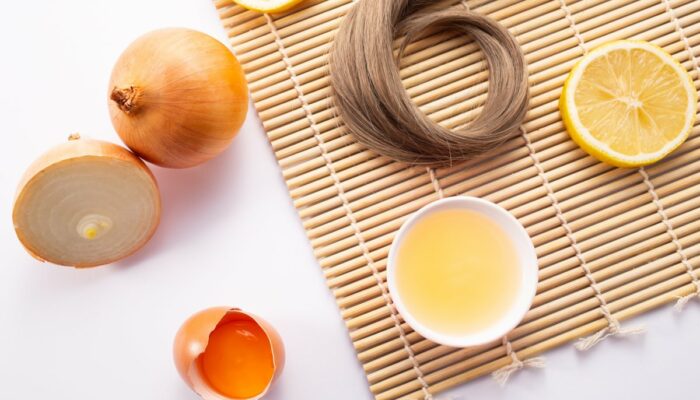 Top 5 home remedies for hair loss